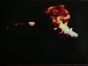 © Carmen Ataque de Caspa